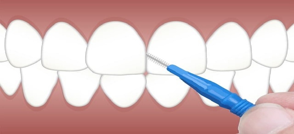 Dental and Oral Health
