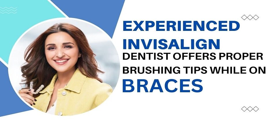 Invisalign Dentist